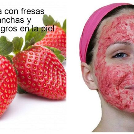 Mascarilla De Fresa Para El Acné y Las Arrugas